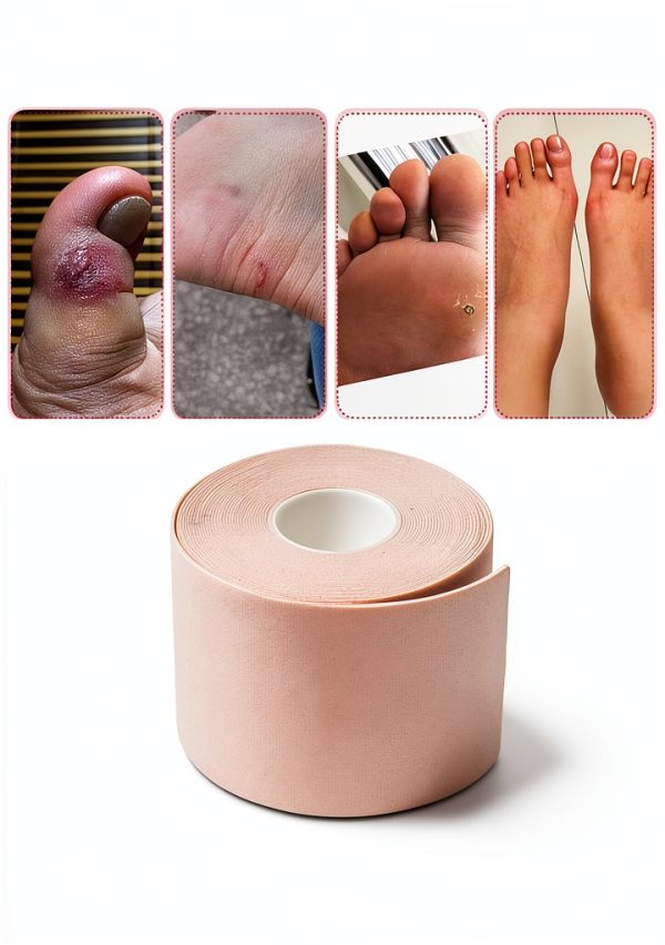 Sticky Foot Roller Sonew Adhesive Pads Wear Resistant Cuttable-4