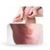 Moleskin Foot Pads 20pcs Soft Velvet Adhesive Cushion by Peutier-4